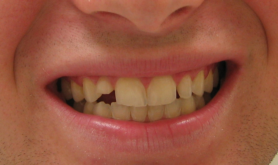 Smile Gallery-Always Genial Dental, Langhorne PA
