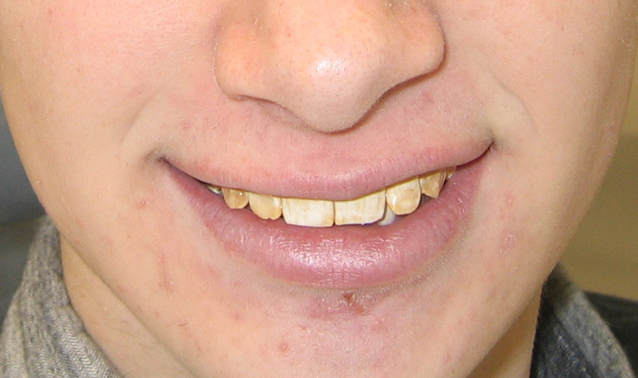 Smile Gallery-Always Genial Dental, Langhorne PA