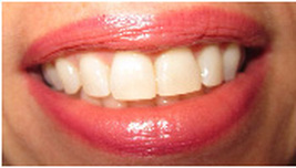 Testimonials-Smile Gallery-Always Genial Dental, Langhorne PA