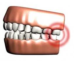 Always Genial Dental  - TMJ Disorder Treatment