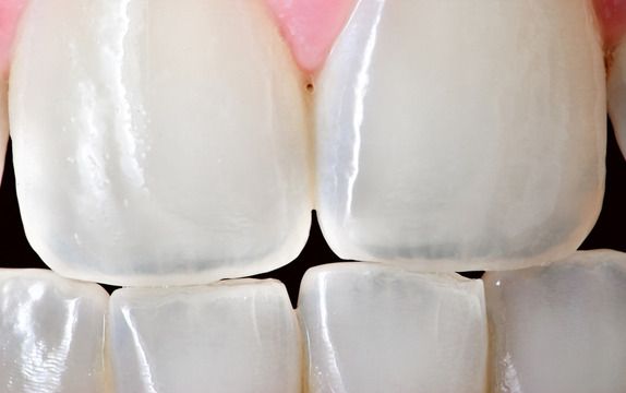 Cosmetic Dentistry-Always Genial Dental, Langhorne PA